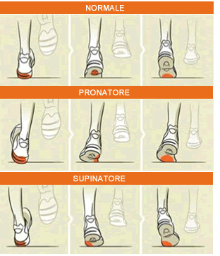 iperpronazione scarpe